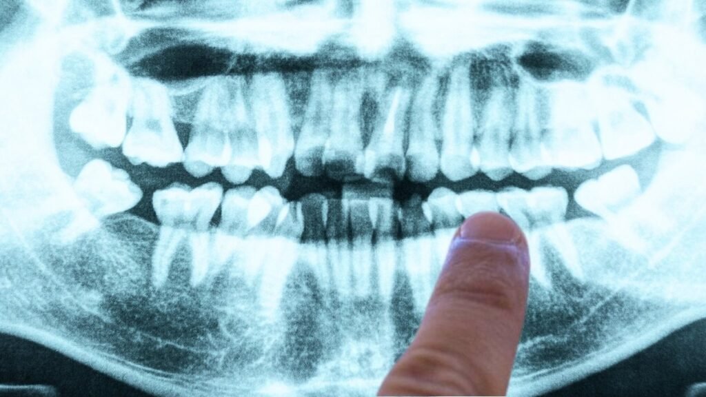Finger-pointing-at-mouth-X-ray-in-bright-blue