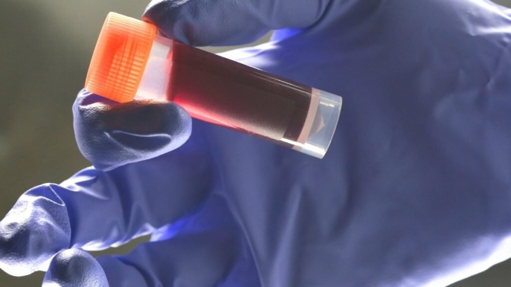 Medical-lab-technician-holding-sample-blood-